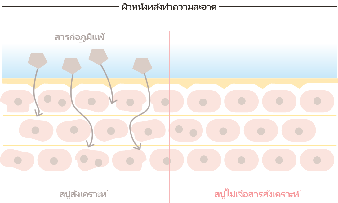 Comparison of skin after washing with synthetic and additive-free soap